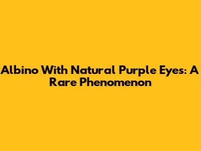 Albino With Natural Purple Eyes: A Rare Phenomenon