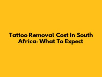 Tattoo Removal Cost In South Africa: What To Expect